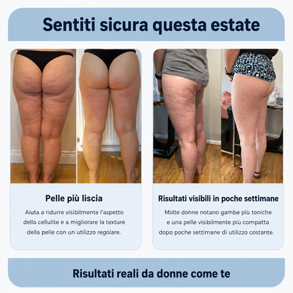 BodyRoll Pro™ – Roller Massaggiante Tonificante